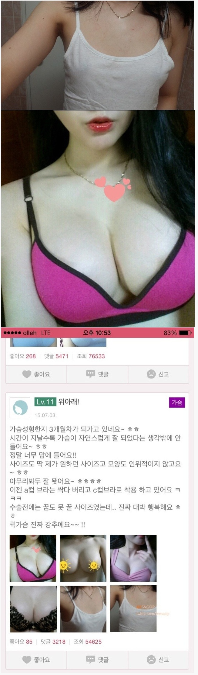 은꼴사