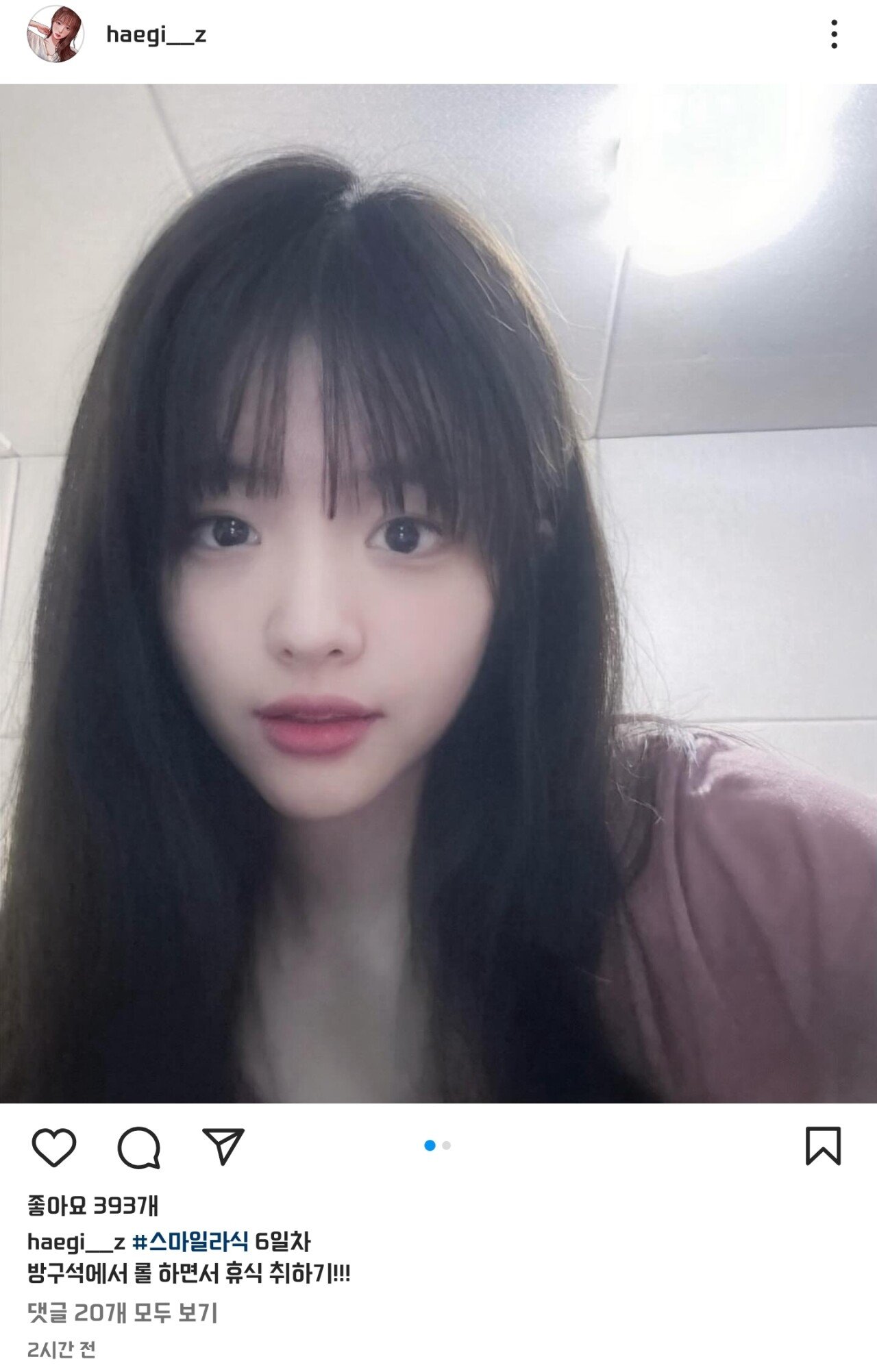 스마일라식 수술 받았다는 해기 현재 상태