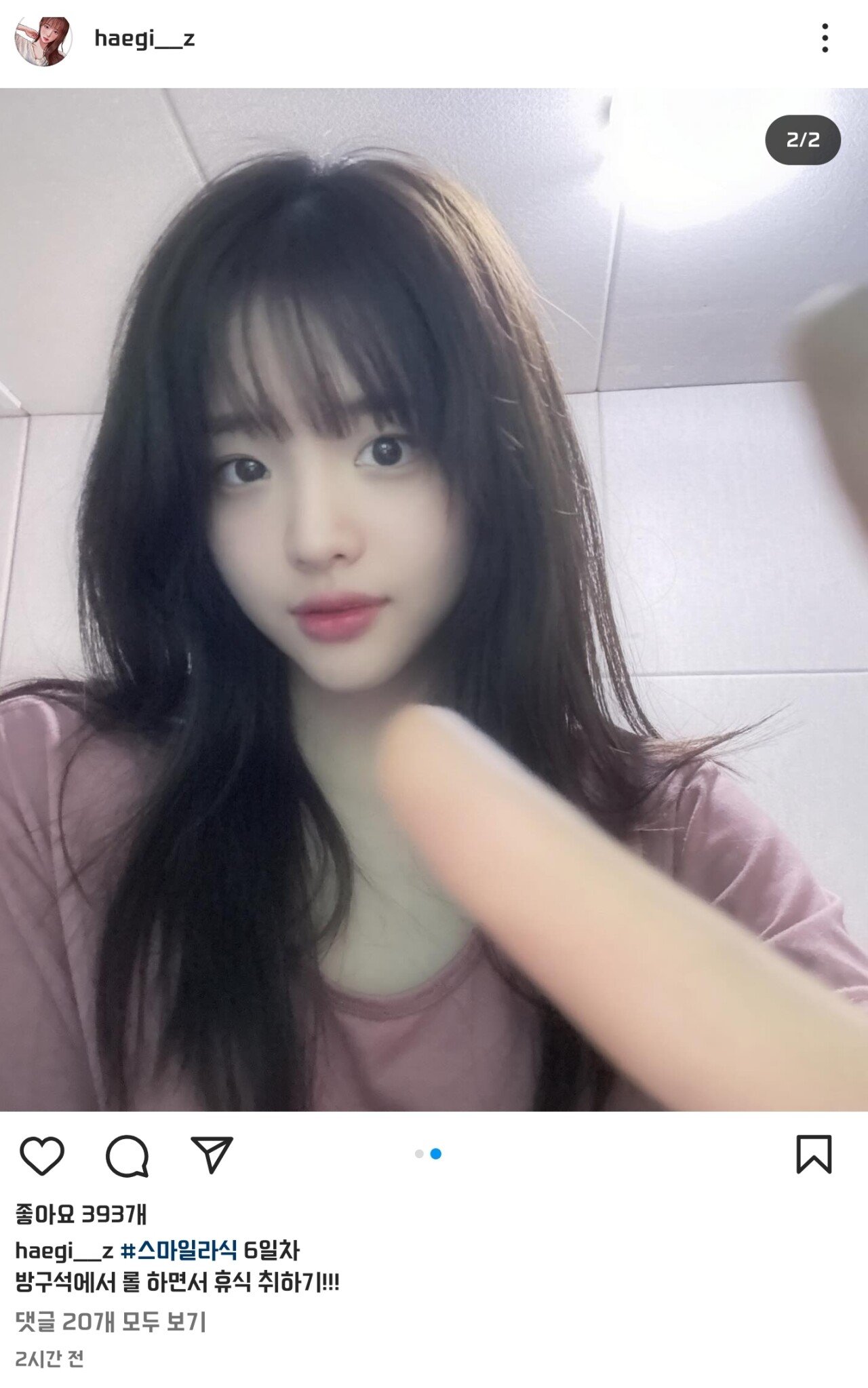 스마일라식 수술 받았다는 해기 현재 상태