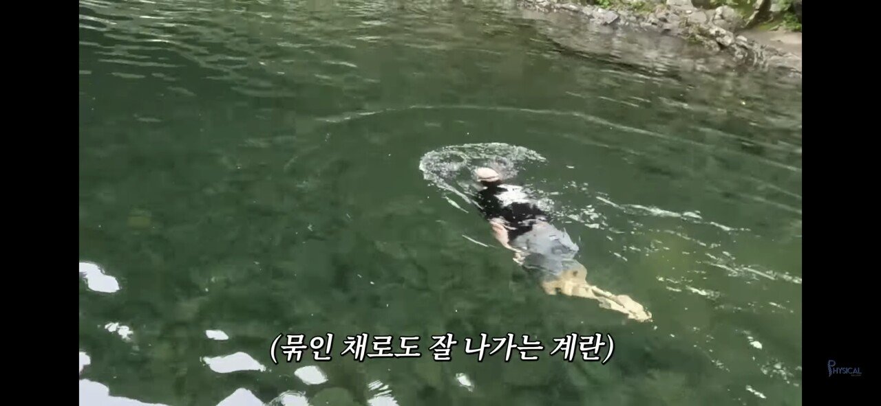 교통사고 크게 당했던 김계란 근황 