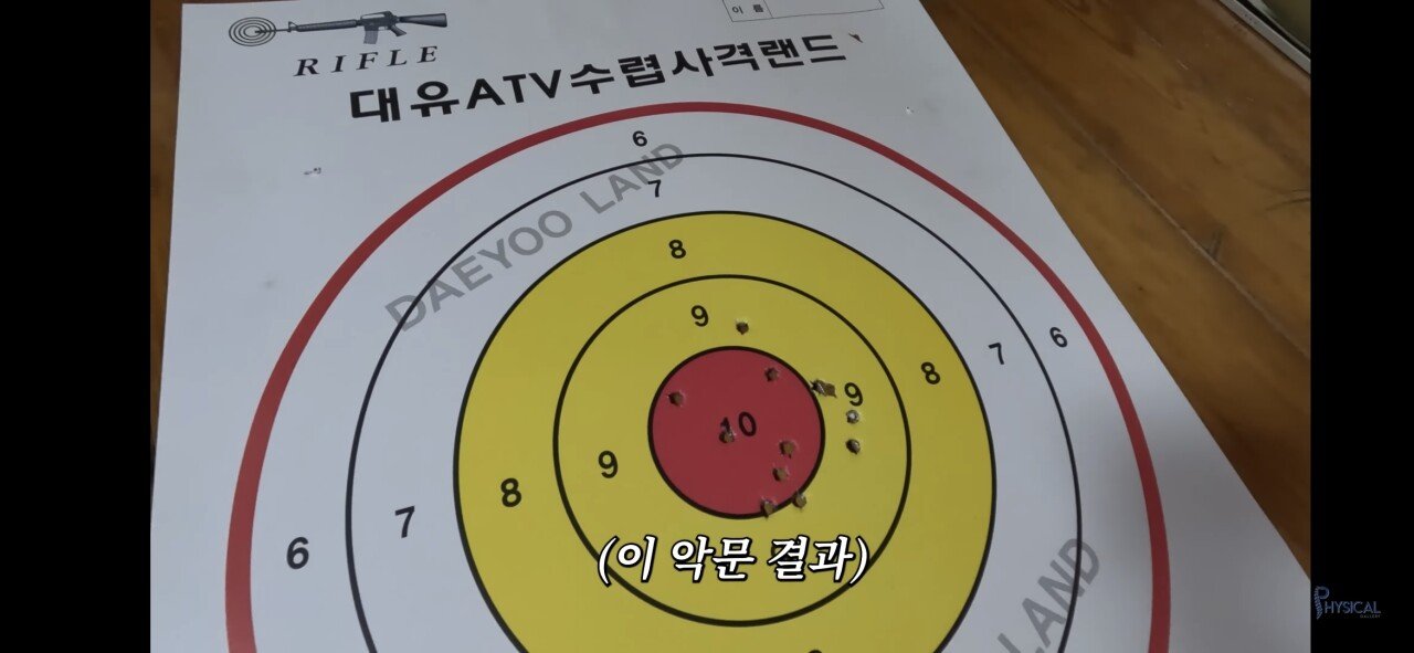 교통사고 크게 당했던 김계란 근황 