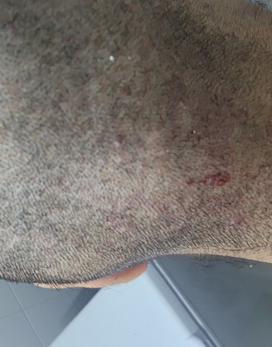 스포츠중계,무료스포츠중계,해외스포츠중계