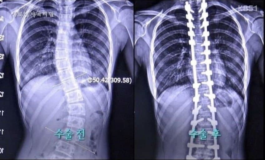 스포츠중계,무료스포츠중계,해외스포츠중계
