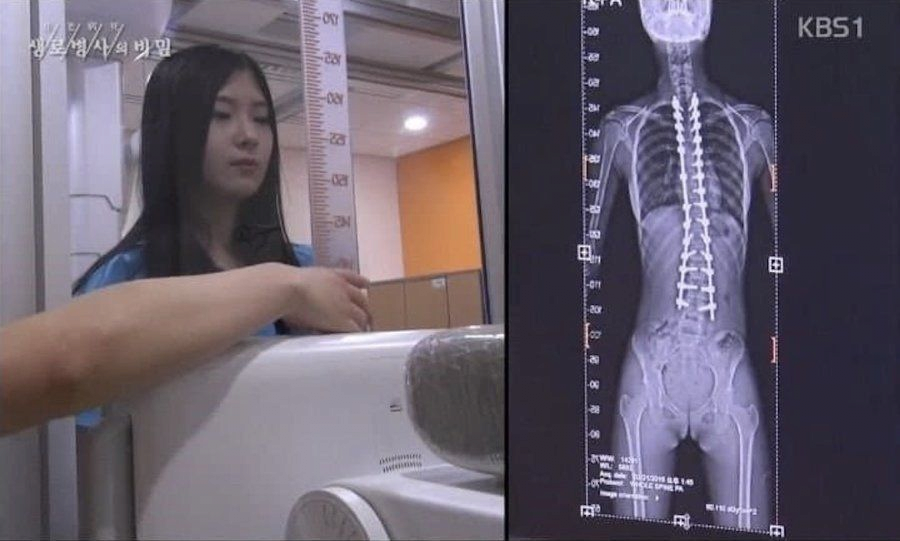 스포츠중계,무료스포츠중계,해외스포츠중계