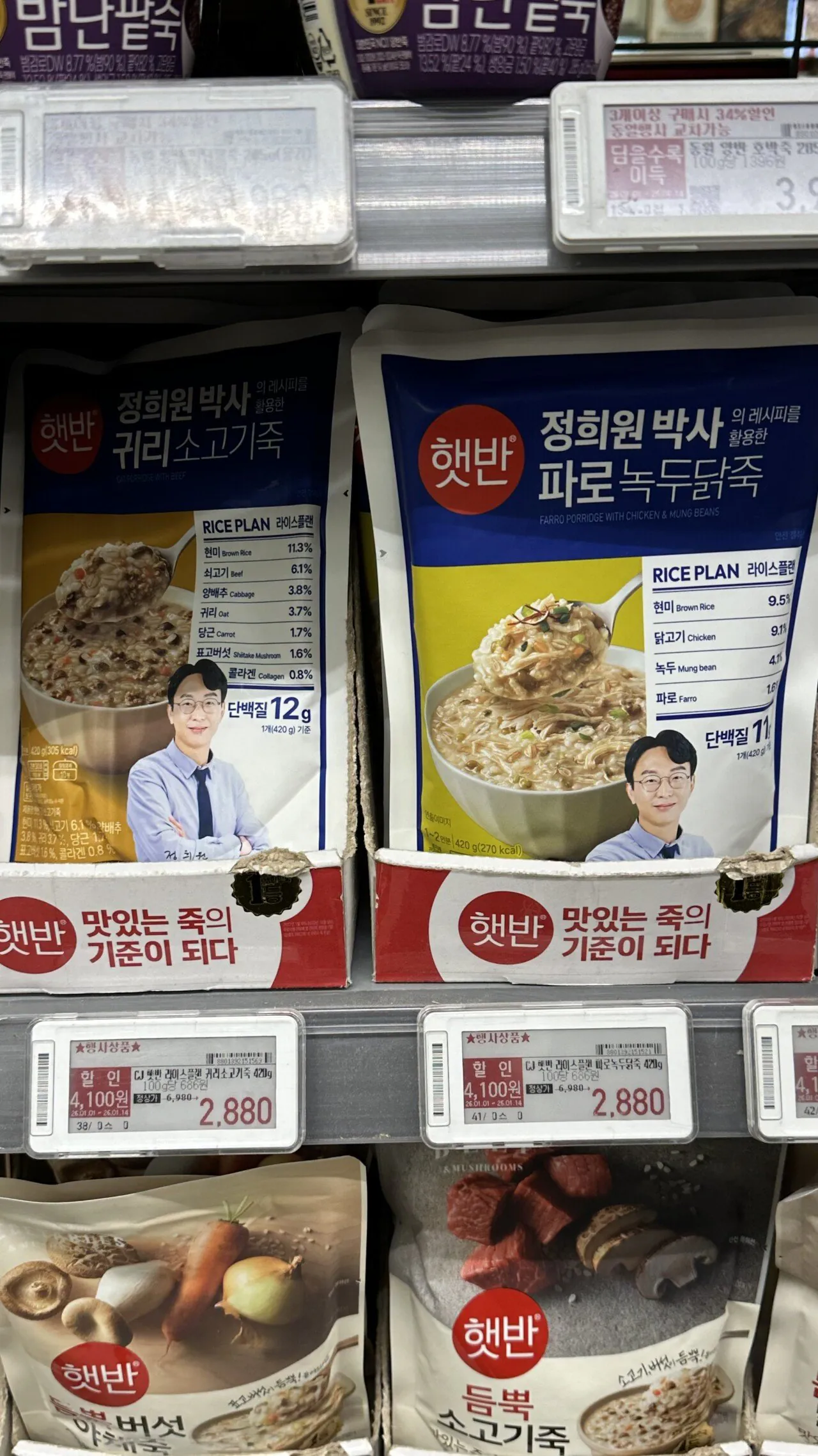 저속노화 정희원 박사 근황 