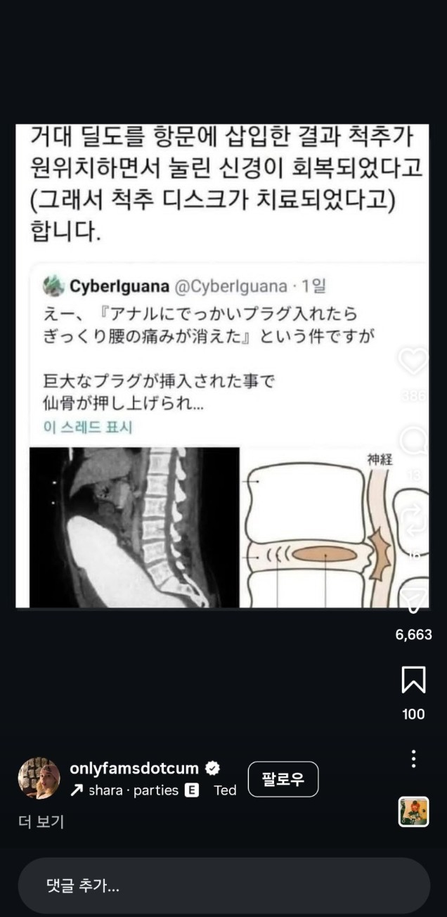 의외로 애널 섹스로 치유할 수 있는 것