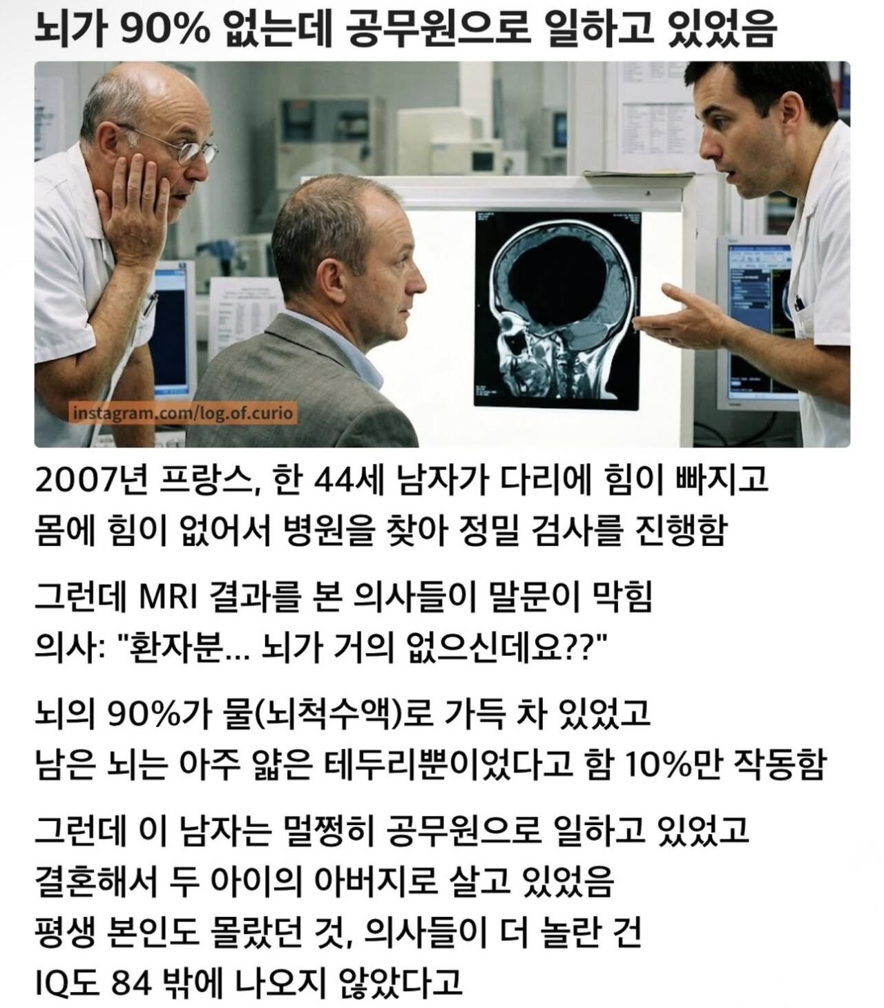 뇌가 90%가 없는데 공무원으로 일하고 있었음 